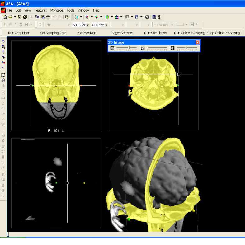 ANT Neuro ASA - MR kaynaklı kafa modeli