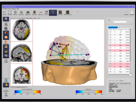 NeuroGuide NeuroNavigator - swLORETA Etkin Bağlantısallık Haritası